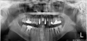 {11085-20150903[00](0)}C