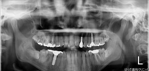 {11519-20140915[00](0)}C