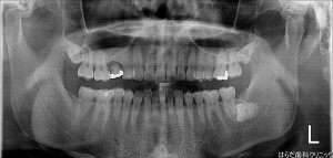 {5471-20150716[00](0)}C