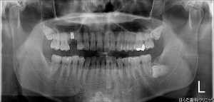 {5471-20150910[00](0)}C