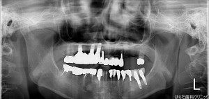 {5653-20150803[00](0)}C