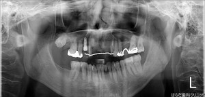 {9442-20150720[00](0)}C