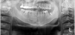 {11778-20160611[00](0)}C