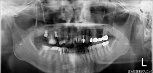 {12690-20160605[00](0)}C