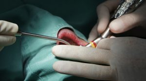 {12690-20160605[01](0)}C